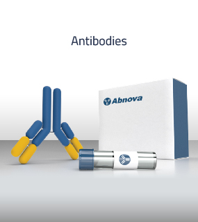 Антитела в основном используются в лабораториях клеточных культур, клинической диагностике, фармацевтике и исследованиях экспрессии белка.
